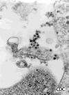 Electron Micrograph of West Nive Virus